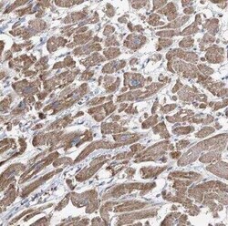 COMMD1 Antibody, Novus Biologicals 0.1 mL; Unconjugated:Antibodies, Polyclonal