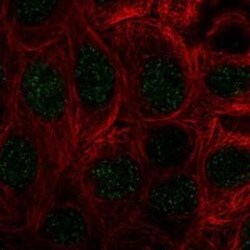 COMMD10 Rabbit anti-Human, Polyclonal, Novus Biologicals 25 &mu;g | Buy Online | Novus Biologicals | Fisher Scientific