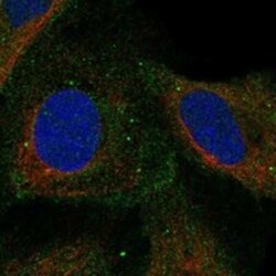 COMMD4 Rabbit anti-Human, Polyclonal, Novus Biologicals 100 &mu;g; Unconjugated:Antibodies,