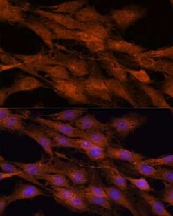 COMMD5 Antibody - Azide and BSA Free, Novus Biologicals 0.02 mL | Buy Online | Novus Biologicals | Fisher Scientific