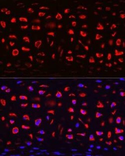 COMP/Thrombospondin-5 Antibody - Azide and BSA Free, Novus Biologicals:Antibodies:Primary