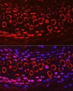 COMP/Thrombospondin-5 Antibody - Azide and BSA Free, Novus Biologicals:Antibodies:Primary