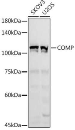 COMP/Thrombospondin-5 Antibody - Azide and BSA Free, Novus Biologicals:Antibodies:Primary