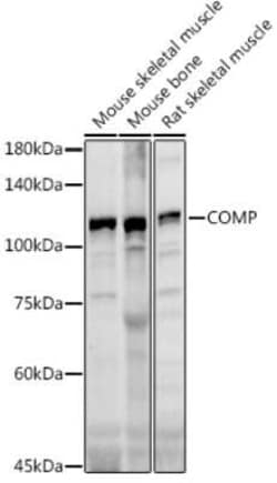 COMP/Thrombospondin-5 Antibody - Azide and BSA Free, Novus Biologicals:Antibodies:Primary