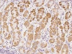COMTD1 Antibody, Novus Biologicals 50 &mu;g, Unconjugated:Antibodies, Polyclonal