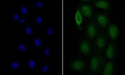 COP9, Rabbit anti-Human,Mouse,Rat, Clone: JE47-48, Novus Biologicals 100