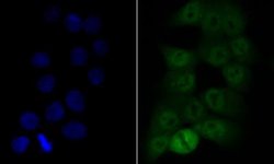 COP9, Rabbit anti-Human,Mouse,Rat, Clone: JE47-48, Novus Biologicals 100