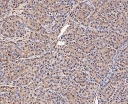 COP9, Rabbit anti-Human,Mouse,Rat, Clone: JE47-48, Novus Biologicals 100