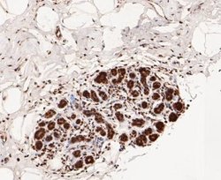 COP9, Rabbit anti-Human,Mouse,Rat, Clone: JE47-48, Novus Biologicals 100