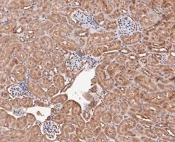 COP9, Rabbit anti-Human,Mouse,Rat, Clone: JE47-48, Novus Biologicals 100