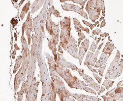 COP9, Rabbit anti-Human,Mouse,Rat, Clone: JE47-48, Novus Biologicals 100
