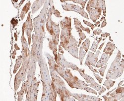 COP9, Rabbit anti-Human,Mouse,Rat, Clone: JE47-48, Novus Biologicals 100
