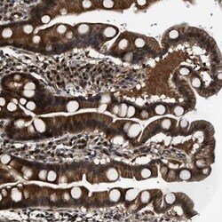 COP9 signalosome complex subunit 2 Antibody, Novus Biologicals 25 &mu;L;