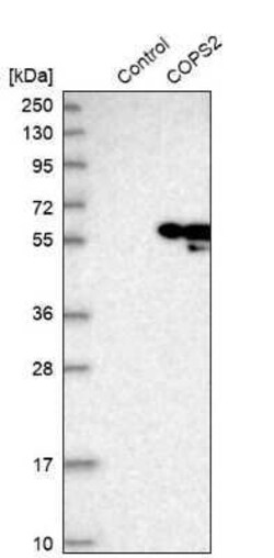 COP9 signalosome complex subunit 2 Antibody, Novus Biologicals 0.1 mL | Buy Online | Novus Biologicals | Fisher Scientific