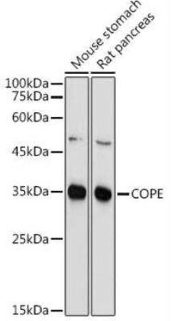 COPE Antibody - BSA Free, Novus Biologicals:Antibodies:Primary Antibodies