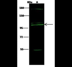 COPG Antibody, Novus Biologicals 100 &mu;g; Unconjugated:Anticorps, Polyclonal
