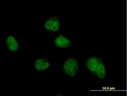COPS8 Antibody, Novus Biologicals 50 &mu;g | Buy Online | Novus Biologicals | Fisher Scientific