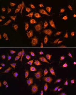 COPZ1 Antibody - Azide and BSA Free, Novus Biologicals:Antibodies:Primary