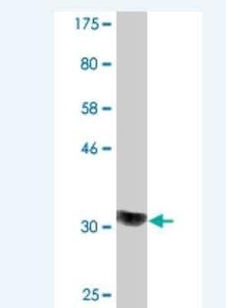 COQ2 Antibody (2B4), Novus Biologicals 0.1 mg | Buy Online | Novus Biologicals | Fisher Scientific
