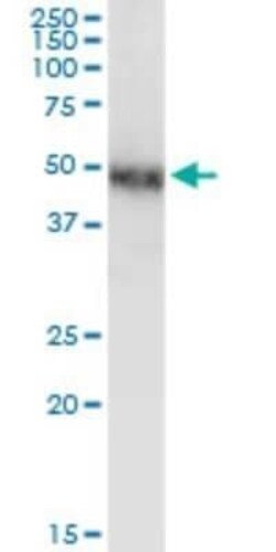 COUP-TF I/NR2F1 Antibody (1A4), Novus Biologicals 0.1 mg | Buy Online | Novus Biologicals | Fisher Scientific