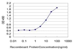 COUP-TF II/NR2F2 Antibody (1D8), Novus Biologicals 0.1 mg, Unconjugated:Antibodies,