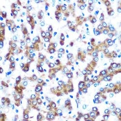 COX-2 Rabbit anti-Human, Mouse, Rat, Clone: 2V7G8, Novus Biologicals:Antibodies:Primary