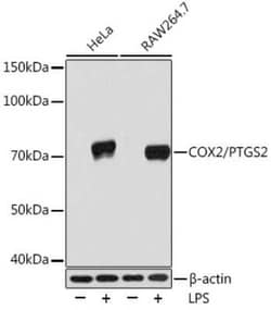 COX-2 Rabbit anti-Human, Mouse, Rat, Clone: 2V7G8, Novus Biologicals:Antibodies:Primary