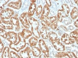 COX-2 Rabbit anti-Human, Clone: COX2/3320R, Novus Biologicals 20 &mu;g;
