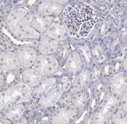COX-2 Antibody, Novus Biologicals 25 &mu;L; Unconjugated:Antibodies, Polyclonal