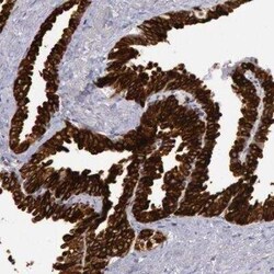 COX-2 Antibody, Novus Biologicals 25 &mu;L; Unconjugated:Antibodies, Polyclonal