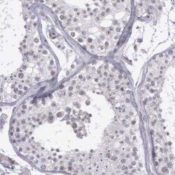 COX-2 Antibody, Novus Biologicals 25 &mu;L; Unconjugated:Antibodies, Polyclonal
