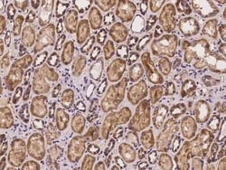 COX11 Antibody, Novus Biologicals 100 &mu;g, Unconjugated:Antibodies, Polyclonal