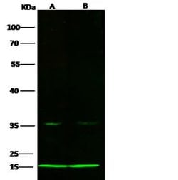COX5b Rabbit anti-Human, Clone: 21, Novus Biologicals 100 &mu;g; Unconjugated:Antibodies,