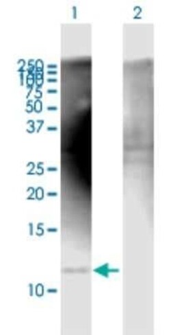 COX7A2L Antibody, Novus Biologicals 0.05 mg | Buy Online | Novus Biologicals | Fisher Scientific