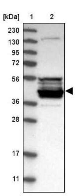 CPA5 Antibody, Novus Biologicals 0.1 mL | Buy Online | Novus Biologicals | Fisher Scientific