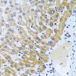 CPA6 Antibody - BSA Free, Novus Biologicals:Antibodies:Primary Antibodies