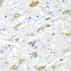 CPA6 Antibody - BSA Free, Novus Biologicals:Antibodies:Primary Antibodies