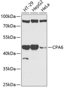 CPA6 Antibody - BSA Free, Novus Biologicals:Antibodies:Primary Antibodies
