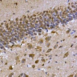 CPEB3 Antibody - Azide and BSA Free, Novus Biologicals:Antibodies:Primary