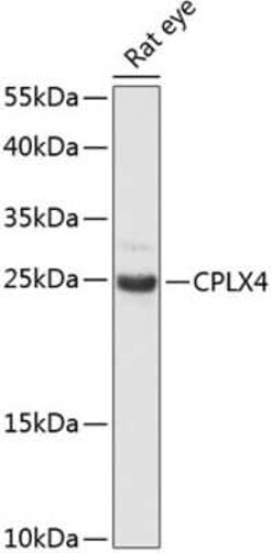 CPLX4 Antibody - Azide and BSA Free, Novus Biologicals:Antibodies:Primary
