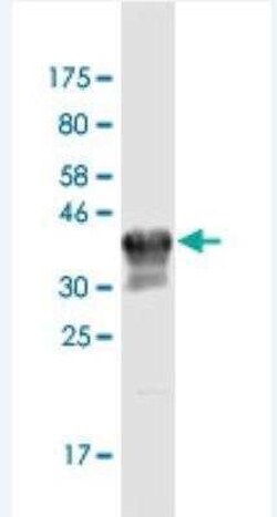 CPNE3 Antibody (4F4), Novus Biologicals 100 &mu;g | Buy Online | Novus Biologicals | Fisher Scientific