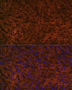CPS1 Rabbit anti-Human, Mouse, Rat, Clone: 1R6W3, Novus Biologicals 20