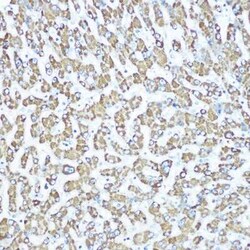 CPS1 Rabbit anti-Human, Mouse, Rat, Clone: 1R6W3, Novus Biologicals 20