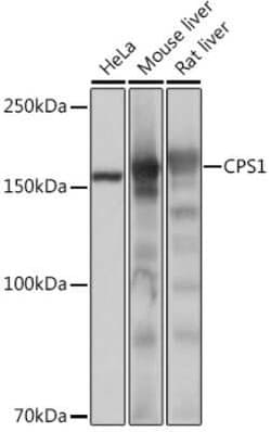 CPS1 Rabbit anti-Human, Mouse, Rat, Clone: 1R6W3, Novus Biologicals 20