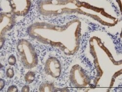 CPS1 Antibody (8H8), Novus Biologicals 0.1 mg | Buy Online | Novus Biologicals | Fisher Scientific