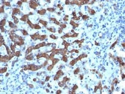 CPS1 Antibody (CPS1/1022), Novus Biologicals:Antibodies:Primary Antibodies