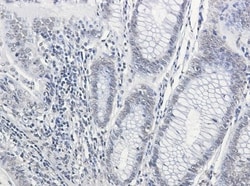 CPS1 Antibody (S01-2A0), Novus Biologicals 100 &mu;g; Unconjugated:Antibodies,
