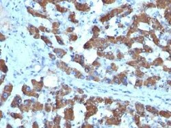 CPS1 Antibody (SPM615), Novus Biologicals:Antibodies:Primary Antibodies
