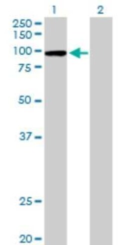CPSF2 Antibody, Novus Biologicals 0.05 mg | Buy Online | Novus Biologicals | Fisher Scientific