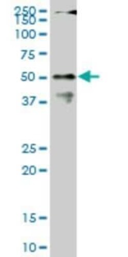 CPSF6 Antibody (1C5), Novus Biologicals 0.1 mg | Buy Online | Novus Biologicals | Fisher Scientific